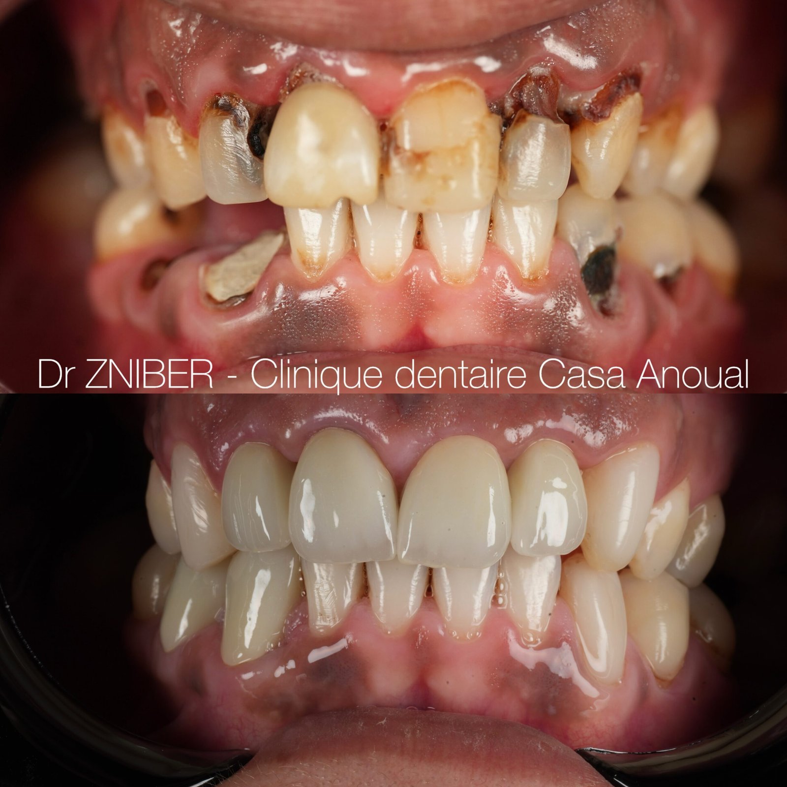 Cas clinique teintes naturelles – Clinique Casa Anoual